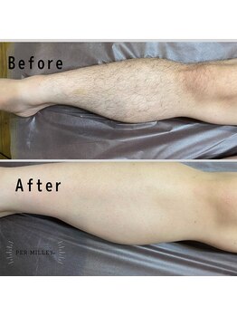 パーミル 楠葉店(per mille‰)/Before/After