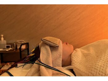 デルタエヌピー63+(δnp63+)/お客様施術例【小顔/薬院/福岡】