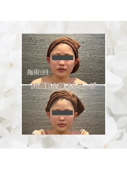 バンブー B2 新涯店(Bamboo)/3D筋膜マッサージ