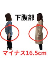 はりま接骨院/下腹部スッキリしませんか？