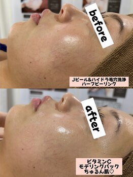 シロ(SHIRO)/毛穴レスののハーブピーリング