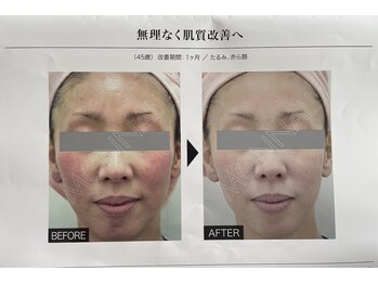 ビューティーフィール(Beauty Feel)/復元パックケアコース