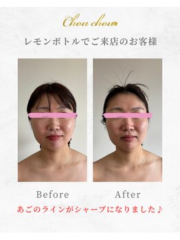 シュシュ(Chouchou)/レッドショット1回