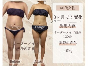 サロン ド ボーテ ラーンジュ 岐阜店(salon de beaut'e L'ange)/ハイパ-ナイフEX2ダイエット痩身
