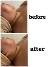 レヌール(LENULE)/フェイシャル