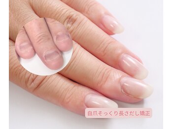 グラシナ なんば店/深爪長さだしそっくり矯正