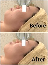 スペチアーレ 夙川/驚きのリフトアップ