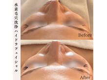 プラウド(Proud)/毛穴洗浄ケア