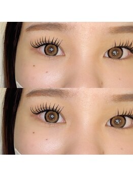 トゥービー(To Be)/バインドロックつけ放題