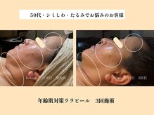 パンセリーノ(Panselinos)/年齢肌対策ララピール