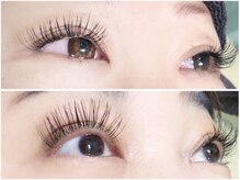 ジュレアイ(JurerEye)/フラットマット140本160本