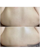 ラクシュミー ナチュラル(Laksmy NATURAL)/お客様ボディビフォーアフター