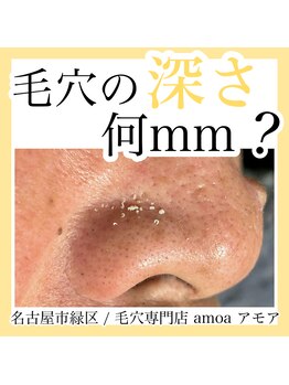 アモア(amoa)/毛穴ケア