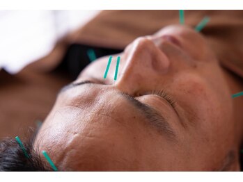 ココロ(CoCoLo)/メンズ美容鍼灸