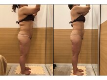 リッツ 浦和ボディ店(Ritz)/【Before/After】痩身