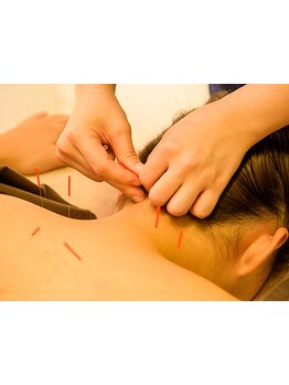 鍼灸施術を受けたい