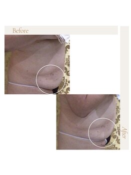 アイ アンド ネイルデイ 桂(EYE＆NAIL DAY)/キャビMAX