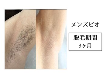 メンズビオ 神戸三宮店/