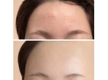 オーシャンスパ(Ocean Spa)の雰囲気（お肌が弱い方は乳酸ピーリング！フェイシャルメニューが豊富！）