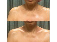 ルビーサロン(ruby-salon)の雰囲気（【首肩コリに】電気ケアは深層コリをゆるめ効果が早いのが特徴）