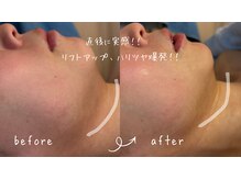 サロン リノ(salon rino)の雰囲気（韓国小顔◎顔のもたつき、今すぐリセット　小顔は作れる時代へ）