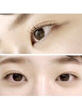 フランセス(Frances)/ラッシュリフト