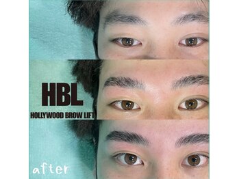 ラマリマ(Lamalima)/