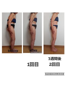 クリオネ(Clione)/新メニュースリム美姿勢メゾット