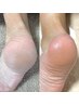 《季節限定》かかとツルツルケア　60分　7,700円