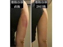 アロマフラワー神楽坂(Aroma Flower)の雰囲気（最先端の脂肪冷却マシンで部分的にも落とせる！）