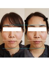 きしの美容整体院/フェイシャルリフトケアBA