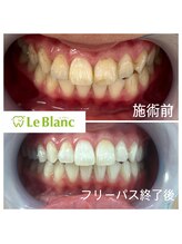 ルブラン 奈良店(Le Blanc)/施術前と後の変化をご覧ください