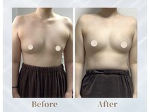 ふじこのみらい by ラディアンヌ/