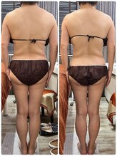 レヴィ(Revie)/60代ウルトラ造形リンパ1回