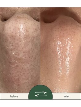 インフィニティ(INFINITY)/-CHRISTINA-アンストレス