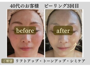 リノミノ(lino'mino)の写真/一生モノの肌質改善でハリツヤUP！サロンケアで変えて、あなた専用のスキンケアでさらに輝かせましょう☆