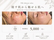 パル 恵比寿(PAL)