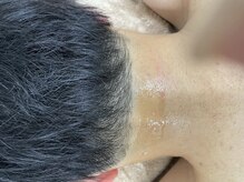 ナノハナ/鹿沼市の全身脱毛美容室ナノハナ