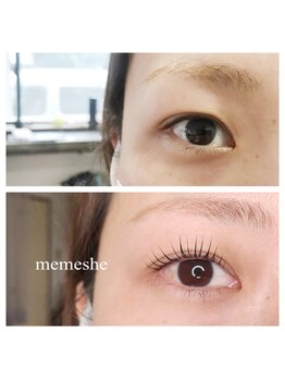 メメシー 相模原(memeshe)/ビフォー/ アフター