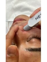 エステサロン オパール(OPALE)/ベタつく毛穴に毛穴洗浄吸引