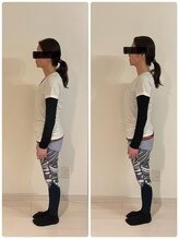 アメリオレ(ameliorer)/美容骨盤矯正