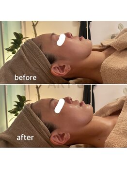 アルテ(ART-e)/Before/Afterプレ花嫁様体験