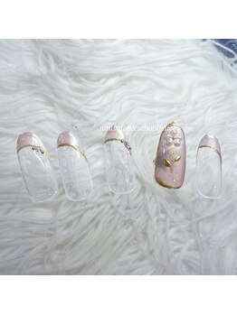 パラジェル定額ゴールドコース