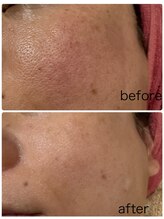 トータルビューティーサロン リリ(Riri)/