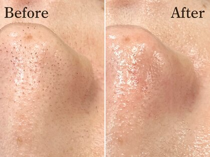 ルーミー 南青山(LUME)の写真