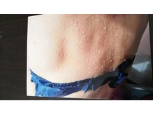 ローブメール(Robemail)/施術後のデトックス汗