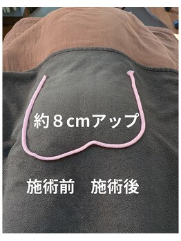 新リンパサロン横浜青葉西 整体院 中澤/骨盤矯正　前後比較