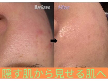 ビノスビューティー(vinos.beauty)の写真