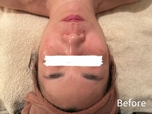 ダイヤモンド リーエンダ(Diamond leende)/クレイハーブピーリング