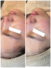 ディオーネ 春日井勝川店(Dione)/マーメイドセルトリートメント